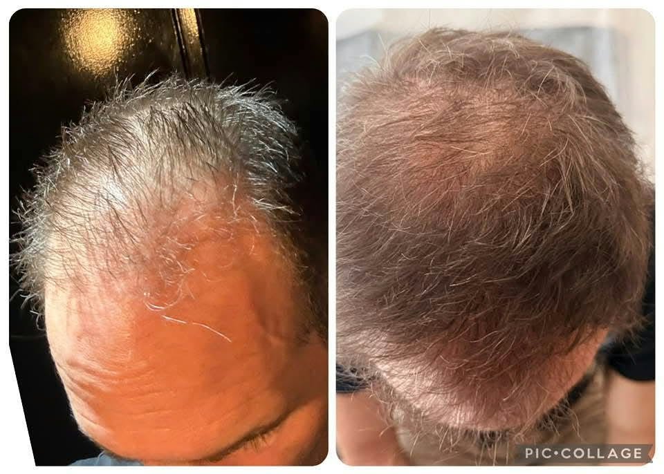 Hair restoration Service photo 1